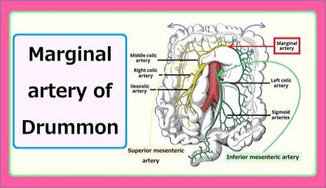 Marie Drummond's Diagnosis: What The Experts Say